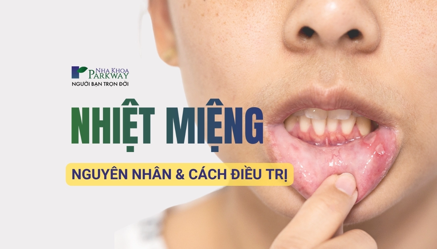 Thường xuyên bị nhiệt miệng là bệnh gì và cảnh báo nguy cơ tiềm ẩn