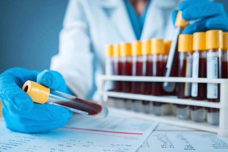 Tìm hiểu chi tiết bệnh hemoglobin e là bệnh gì và các thông tin cần biết