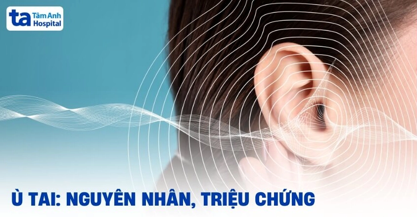 Tìm hiểu chi tiết nguyên nhân ù tai là bệnh gì và cách phòng ngừa
