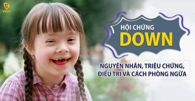 Tìm hiểu chi tiết về trisomy 21 là bệnh gì và các thông tin liên quan