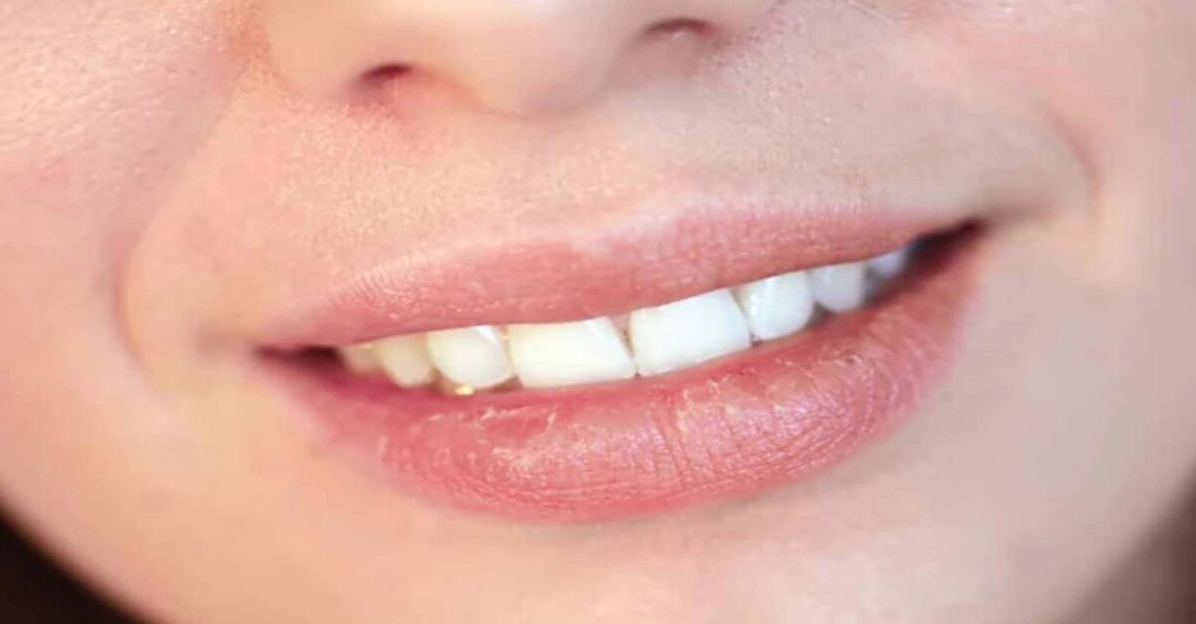 Tìm hiểu hiện tượng khô miệng là bệnh gì và cách xử lý hiệu quả