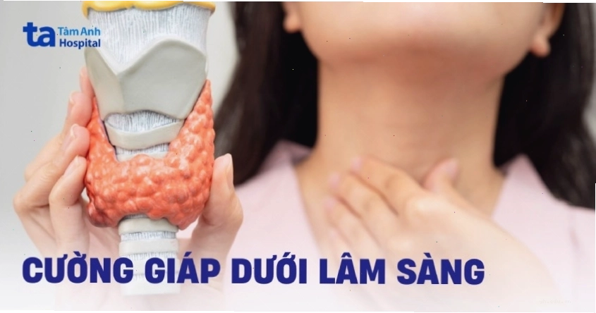 Tìm hiểu về cường giáp dưới lâm sàng