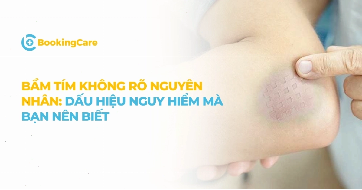 Tình trạng bầm tím không rõ nguyên nhân trên cơ thể