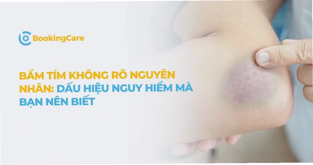 Tình trạng bầm tím không rõ nguyên nhân trên da