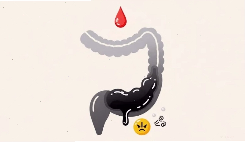 Tình trạng phân đen kéo dài