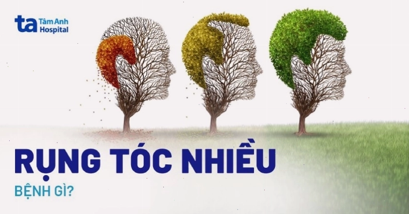 Tình trạng rụng tóc nhiều