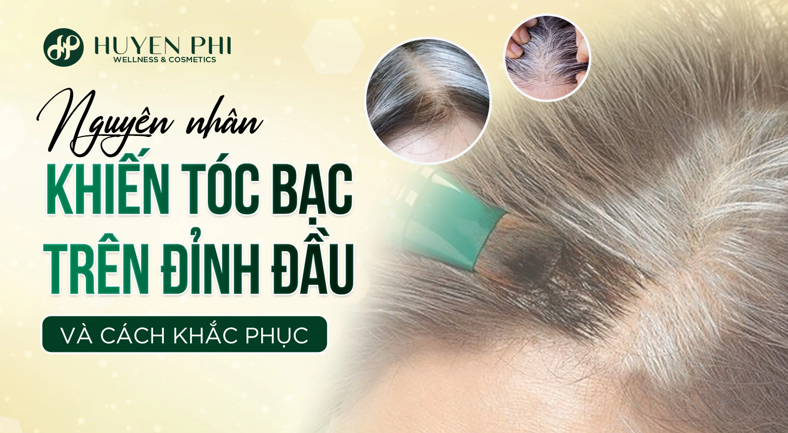 Tóc bạc ở đỉnh đầu là bệnh gì và những lưu ý y khoa quan trọng
