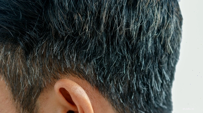 Tóc bạc sớm có thể cần theo dõi thêm