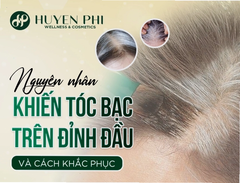 Toc Bac Tren Dinh Dau 1