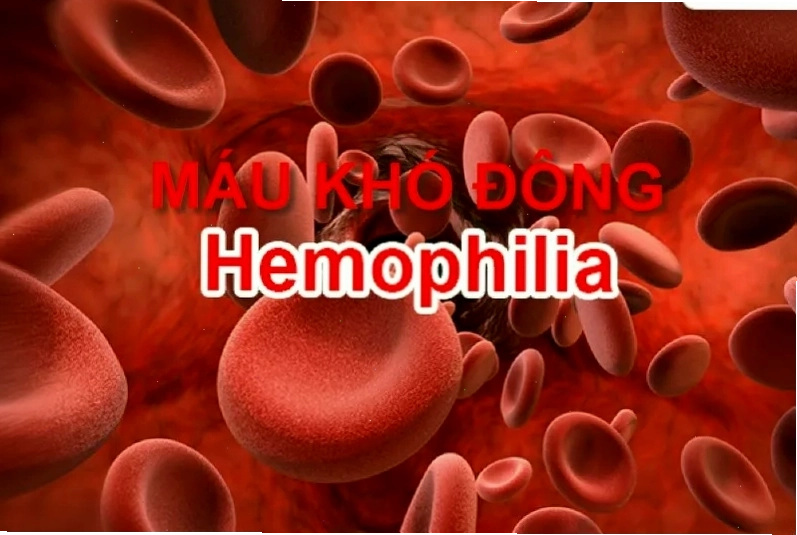 Tổng quan về bệnh máu khó đông và cách điều trị
