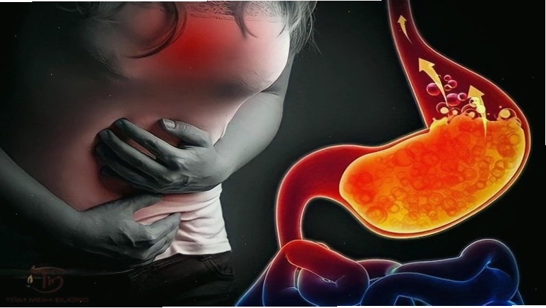 Trào ngược dạ dày thực quản là một bệnh lý liên quan đến nấc cụt