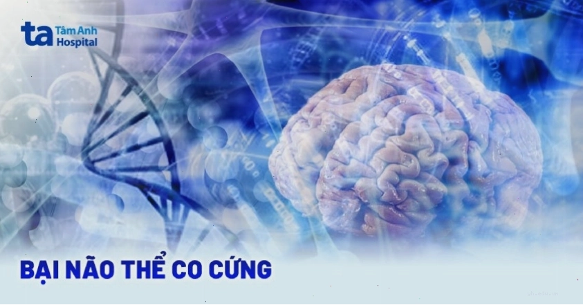 Trẻ bị cứng cơ do bại não