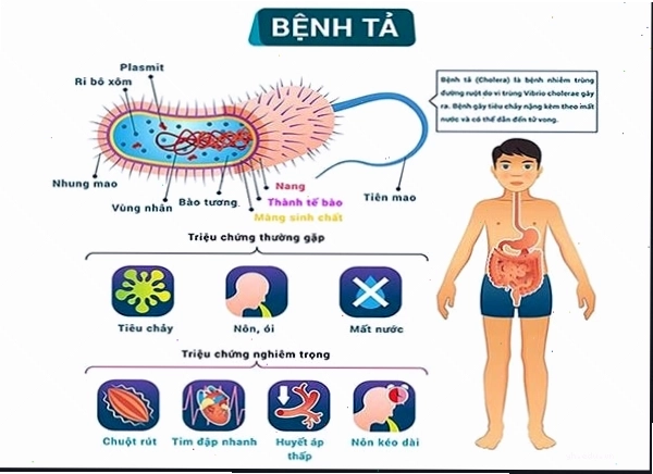 Triệu chứng bệnh tả và cách nhận biết