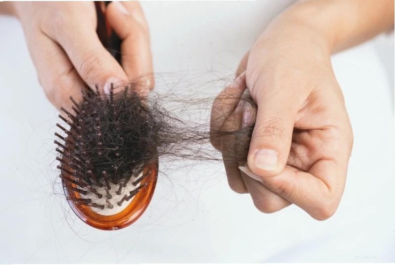 Triệu chứng rụng tóc từng mảng