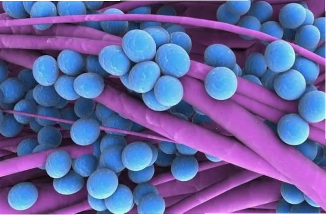 Tụ cầu staphylococcus có thể là nguyên nhân bệnh đau mắt đỏ