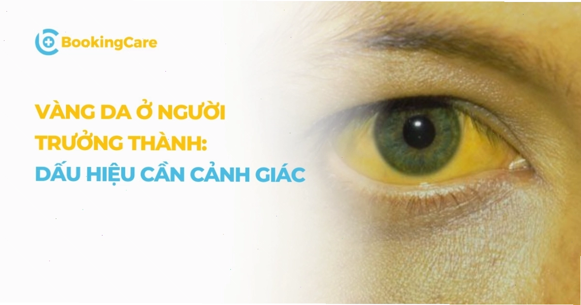 Vàng da vàng mắt ở người lớn