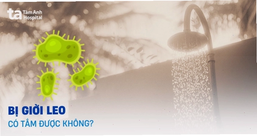 Vệ sinh da khi bị giời leo