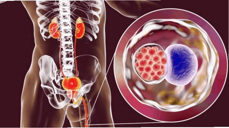 Vi khuẩn Chlamydia là một trong những tác nhân phổ biến nhất