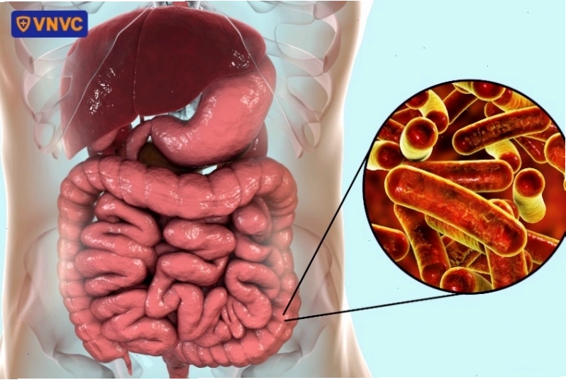 Vi khuẩn Shigella gây bệnh kiết lỵ ở người