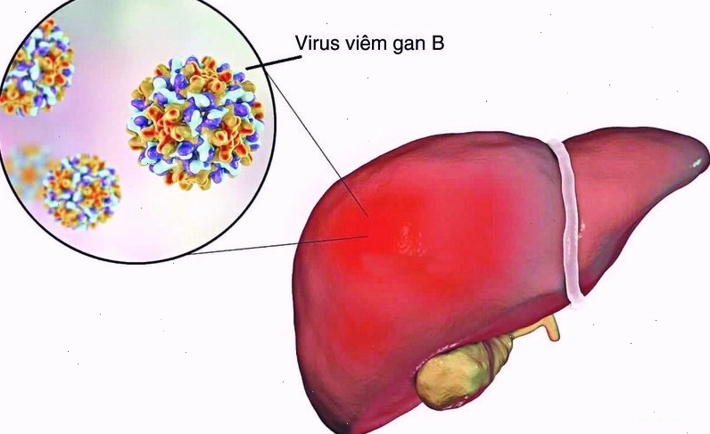 Viêm gan B và C có thể lây qua đường tình dục