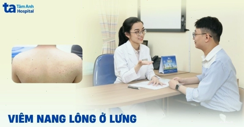 Viêm nang lông ở lưng dưới góc nhìn cận cảnh