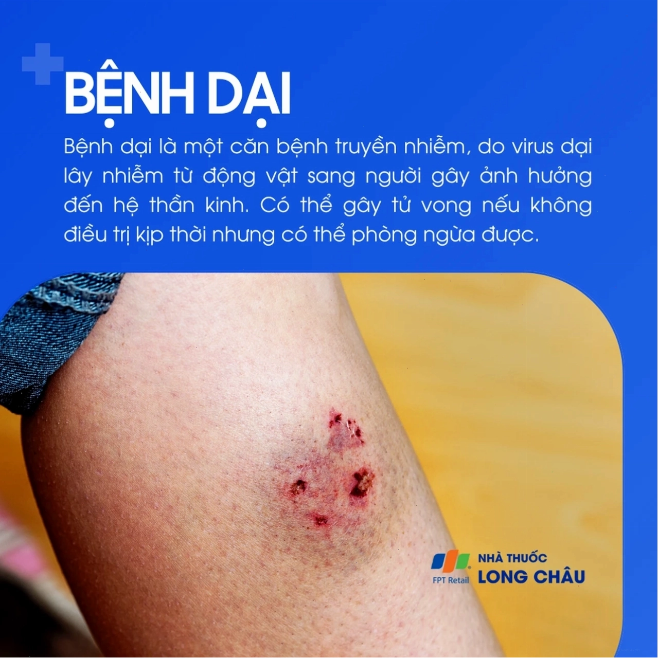 Virus bệnh dại gây tử vong nếu không điều trị