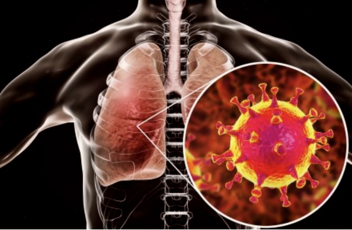 Virus gây ra căn bệnh MERS-CoV nguy hiểm