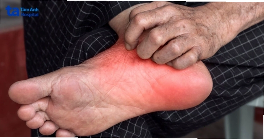 Vùng da phát ban ngứa dữ dội vào ban đêm