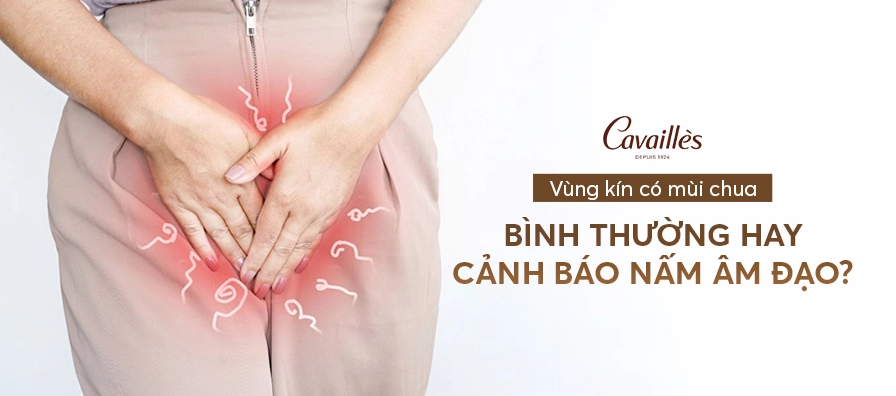 Vùng kín có mùi chua là bệnh gì và những lưu ý y khoa quan trọng