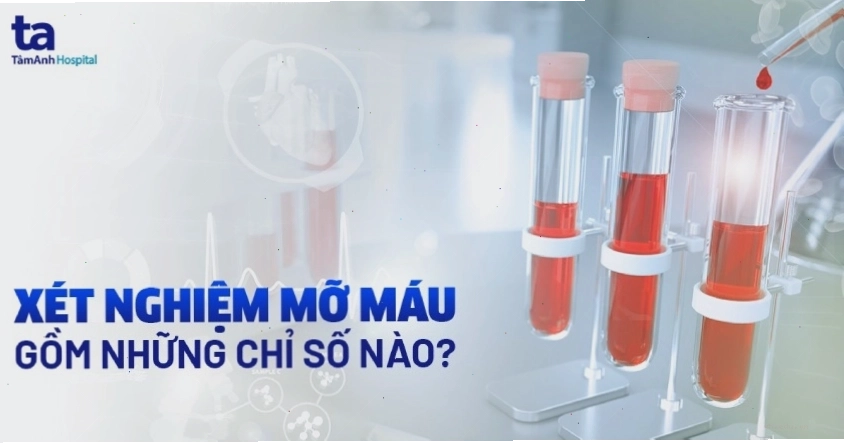 Xét nghiệm chỉ số mỡ máu