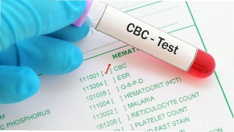 Xét nghiệm công thức máu là bước cần thiết để chẩn đoán nguyên nhân da xanh xao