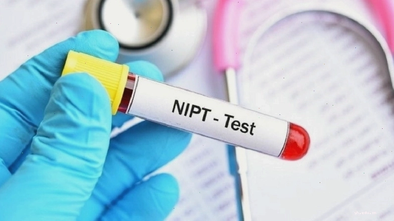 Xét nghiệm di truyền NIPT kiểm tra 23 cặp nhiễm sắc thể