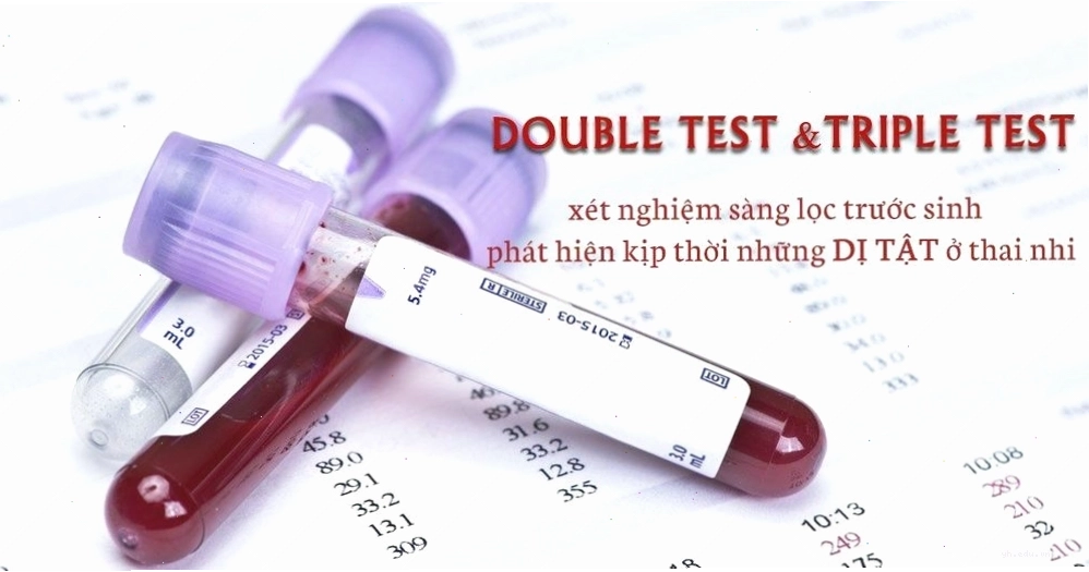 Xét nghiệm Double Test giúp phát hiện nguy cơ dị tật bẩm sinh