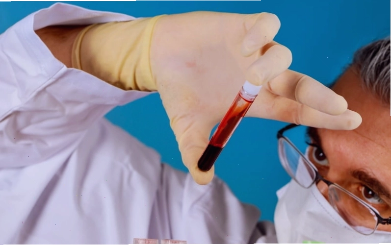 Xét nghiệm máu màu đen, đó là một dấu hiệu bất thường và cần được tìm hiểu kỹ hơn.