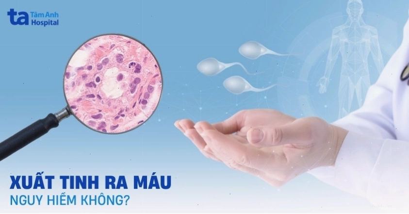 Xuất tinh ra máu có nguy hiểm không và biến chứng tiềm ẩn